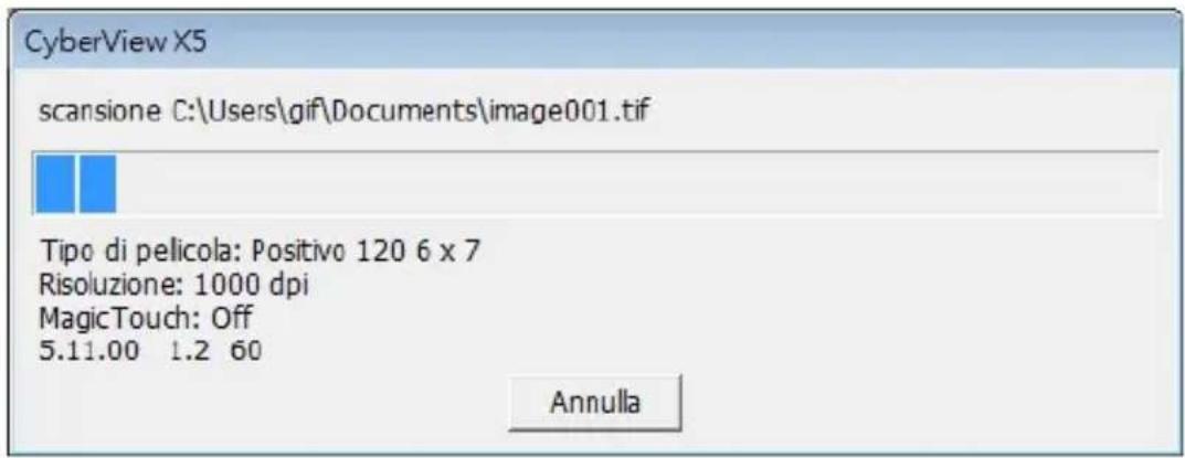 BRAUN CyberView X5 - Scansione (segue...) - 1