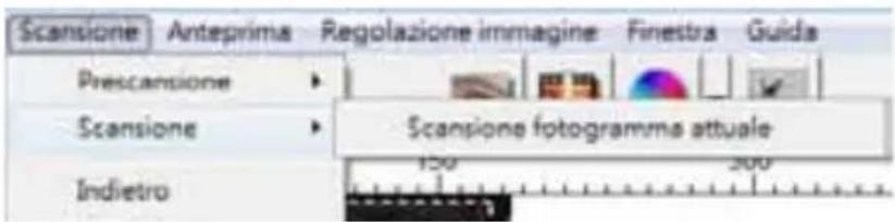 BRAUN CyberView X5 - FASE 6 - Sacn (Scansione) - 1
