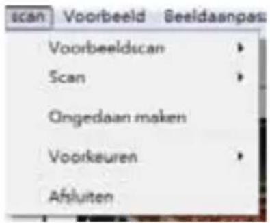 BRAUN CyberView X5 - Menuopdrachten - Scan (overzicht) - 1