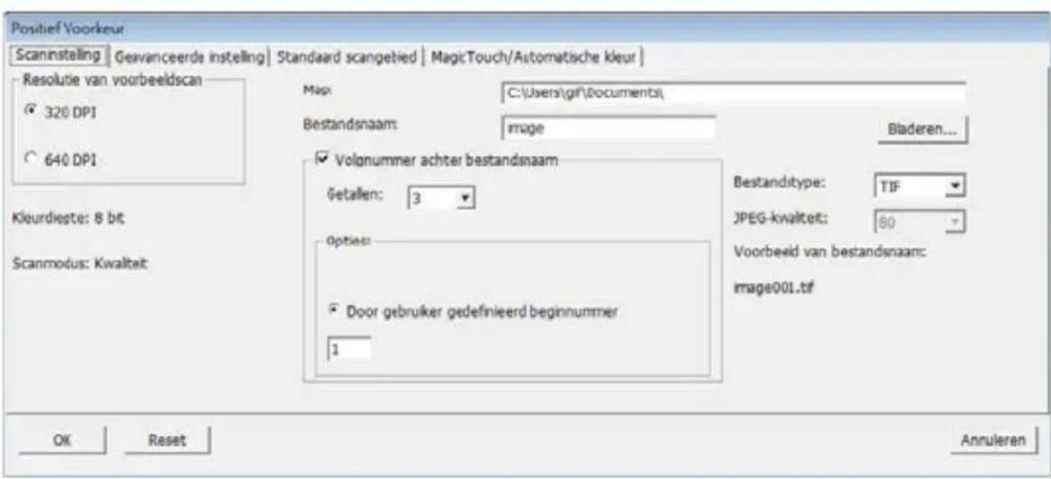 BRAUN CyberView X5 - STAP 4 - Set Scan Settings (scaninstallingen vastleggen) - 1