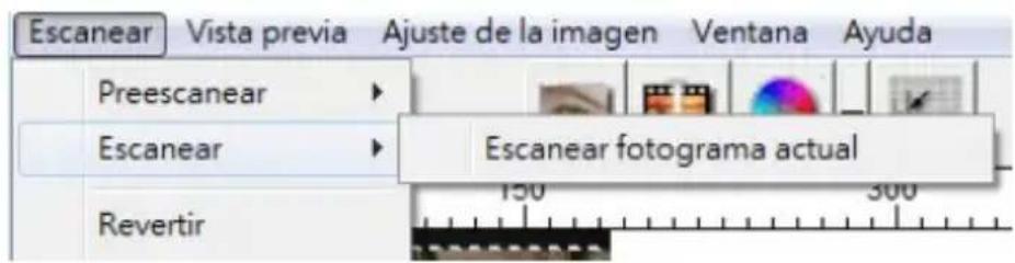 BRAUN CyberView X5 - PASO 6 - Scan (Digitalizar) - 1