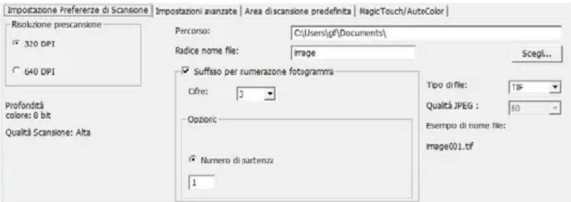 BRAUN CyberView X5 - FASE 4 - Scan Settings (Impostazioni di scansione) - 1