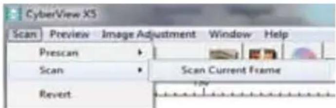 BRAUN CyberView X5 - STEP 6 - Scan - 1