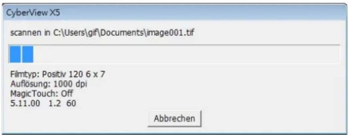 BRAUN CyberView X5 - Scannen (Fortsetzung) - 1
