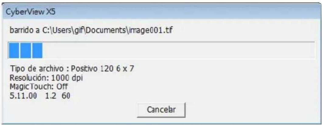 BRAUN CyberView X5 - Scan (Digitalizar) (continuación...) - 1