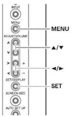 PIONEER PRO1010HD - Setting INPUT1 SELECT - 1