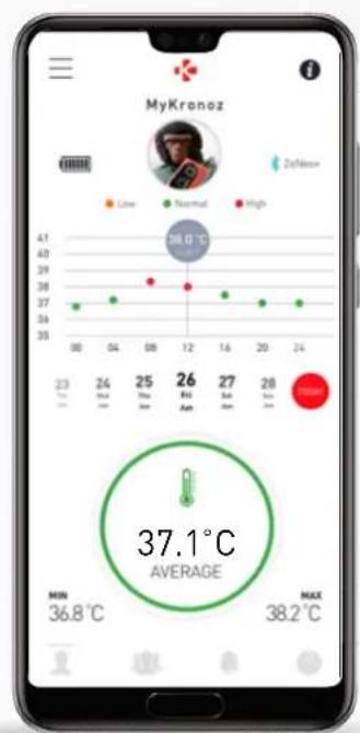 MYKRONOZ ZeTrack+ - COMMENT ANALYSER ET INTERPRETER LES DONNÉES RELATIVES À LA TEMPERATURE CORPORELLE? - 2