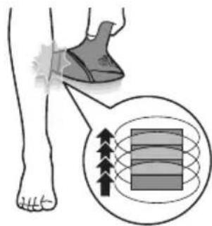 PHILIPS Lumea Prestige BRI948 - Two treatment modes: Stamp & Flash and Flash - 2
