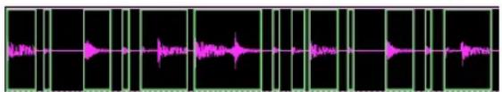 Avid Pro Tools 7.0 - Utilisation de la suppression du silence - 1