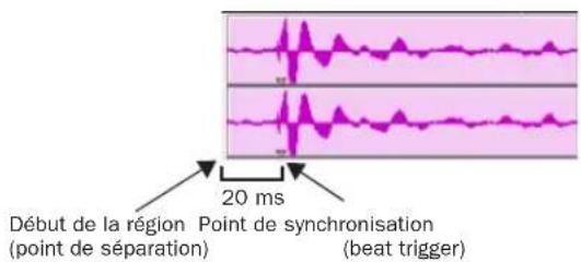 Avid Pro Tools 7.0 - Paramètres de détection, mode Region Separation - 1