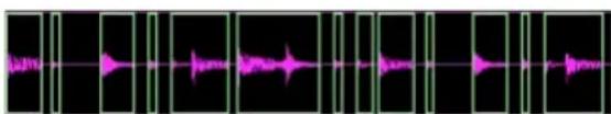 Avid Pro Tools 7.3 - Pour supprimer le silence d'une sélection audio : - 1