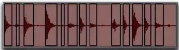 Avid Pro Tools 8.0 - Pour supprimer le silence d'une sélection audio : - 2