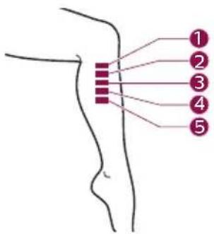 PHILIPS Lumea 9000 Series BRI957 - B Test skin 24 hrs before treatment - 9