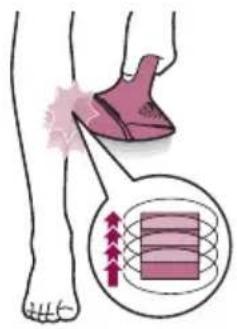 PHILIPS Lumea 9000 Series BRI957 - C Treatment - 6