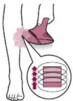 PHILIPS Lumea 9000 Series BRI957 - Two treatment modes: Stamp & Flash and Slide & Flash - 2