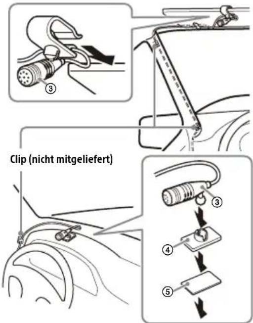 SONY XAVAX8150 - Installieren des Mikrofons - 1