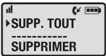 Clarity Professional XLC3.4 - EXAMPLE 2 (ci-dessus): - 11