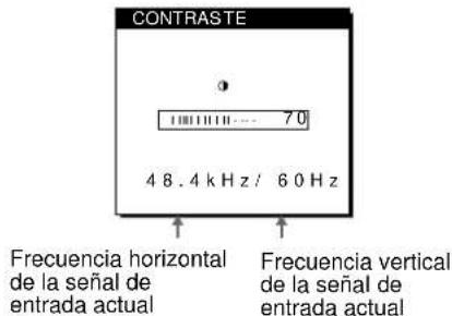 SONY SDMN50R - Pulse el botón (contraste). - 1
