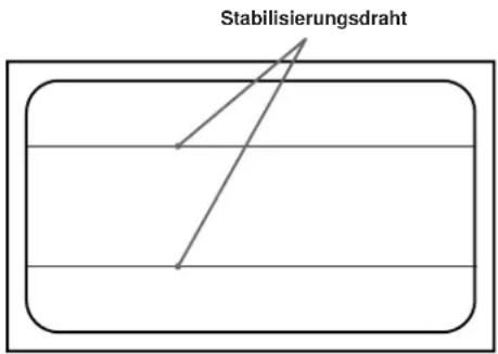 SONY GDM90W01T5 - Stabilisierungsdrähte - 1