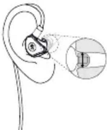 Line drawing of an ear with a device inserted, showing a magnified inset (no text or symbols)