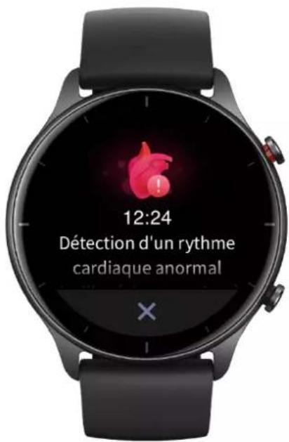 AMAZFIT GTR 2e - Alertes de fréquence cardiaque anormale - 1