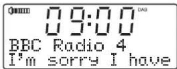 ROBERTS Sound100 - Radio DAB - 2