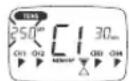 BEURER EM 80 - Changing application (completely or single parameters) - 3