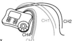 BEURER EM 80 - Distance entre les electrodes - 1