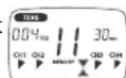 BEURER EM 80 - Modification de l'intensité (pendant l'utilisation) - 5