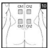 BEURER EM 44 - Positioning the Electrodes - 10