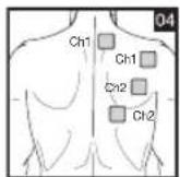 BEURER EM 44 - Positioning the Electrodes - 4