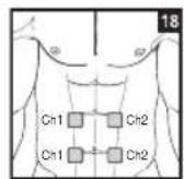 BEURER EM 44 - Positioning the Electrodes - 18