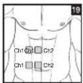BEURER EM 44 - Positioning the Electrodes - 19