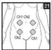 BEURER EM 44 - Positioning the Electrodes - 21