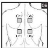 BEURER EM 44 - Positioning the Electrodes - 6