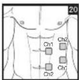 BEURER EM 44 - Positioning the Electrodes - 20