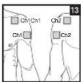 BEURER EM 44 - Positioning the Electrodes - 13