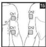 BEURER EM 44 - Positioning the Electrodes - 15