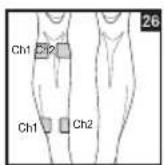 BEURER EM 44 - Positioning the Electrodes - 26