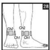 BEURER EM 44 - Positioning the Electrodes - 28