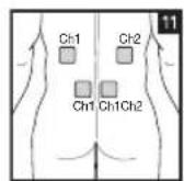 BEURER EM 44 - Positioning the Electrodes - 11