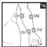 BEURER EM 44 - Positioning the Electrodes - 16