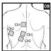 BEURER EM 44 - Positioning the Electrodes - 9