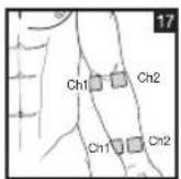 BEURER EM 44 - Positioning the Electrodes - 17