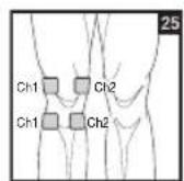 BEURER EM 44 - Positioning the Electrodes - 25