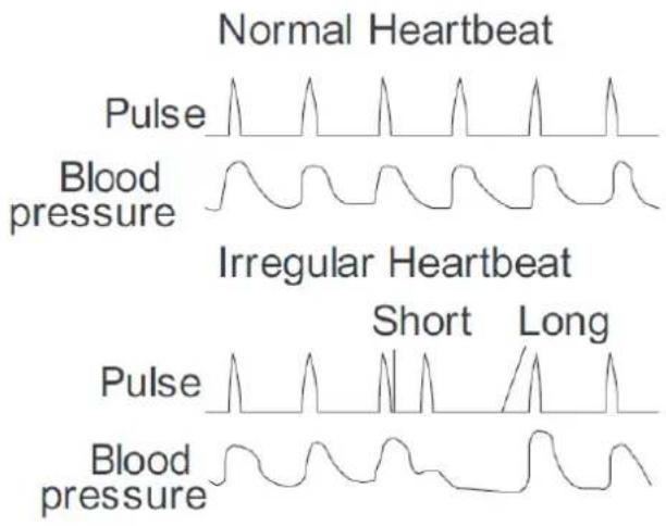 Orbegozo TES 3650 - IIRREGULAR HEARTBEAT SYMBOL - 1