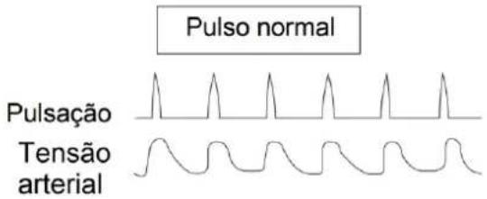 Orbegozo TES 3650 - DETEÇÃO DE PULSO IRREGULAR - 1