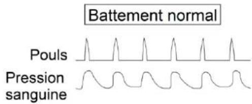 Orbegozo TES 3650 - DÉTECTION D'UN RYTHME CARDIAQUE IRRÉGULIER - 1