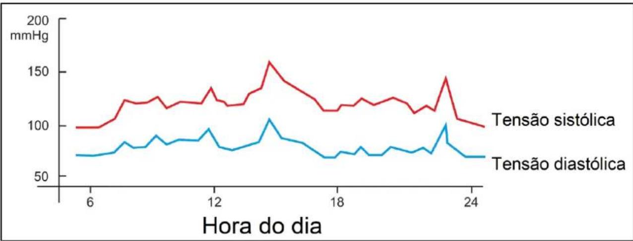 Orbegozo TES 3650 - Saúde e tensão arterial - 1