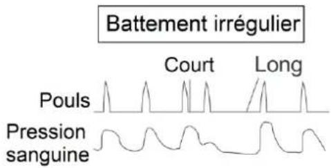 Orbegozo TES 3650 - DÉTECTION D'UN RYTHME CARDIAQUE IRRÉGULIER - 2